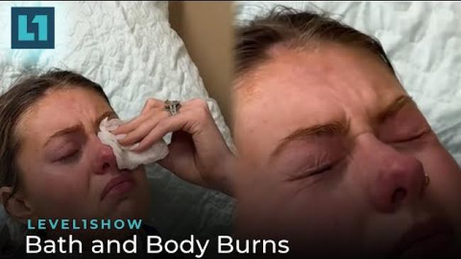Embedded thumbnail for The Level1 Show March 29 2024: Bath and Body Burns
